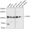 Coatomer Protein Complex Subunit Gamma 1 antibody, A10394, Boster Biological Technology, Western Blot image 