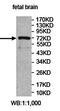 Zinc Finger Protein 23 antibody, orb78022, Biorbyt, Western Blot image 