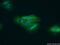 Glycogen Phosphorylase B antibody, 55380-1-AP, Proteintech Group, Immunofluorescence image 