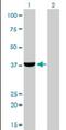 Aldo-Keto Reductase Family 1 Member C4 antibody, orb94630, Biorbyt, Western Blot image 