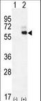 Kininogen 1 antibody, LS-B10444, Lifespan Biosciences, Western Blot image 