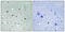 Large Tumor Suppressor Kinase 1 antibody, A01051T1079, Boster Biological Technology, Immunohistochemistry paraffin image 