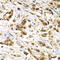 MAGE Family Member A1 antibody, LS-C346090, Lifespan Biosciences, Immunohistochemistry paraffin image 