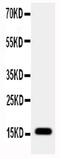 Retinol Binding Protein 2 antibody, PA5-79918, Invitrogen Antibodies, Western Blot image 