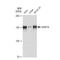 Chromatin Assembly Factor 1 Subunit A antibody, GTX03244, GeneTex, Western Blot image 