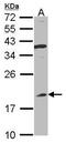 Interferon Alpha 8 antibody, PA5-21679, Invitrogen Antibodies, Western Blot image 