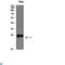 Parathyroid Hormone Like Hormone antibody, LS-C813552, Lifespan Biosciences, Western Blot image 