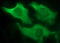 Interleukin 10 Receptor Subunit Alpha antibody, M03597, Boster Biological Technology, Immunofluorescence image 