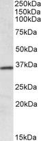 HOX1D antibody, EB10043, Everest Biotech, Western Blot image 