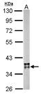Malate Dehydrogenase 2 antibody, LS-B10823, Lifespan Biosciences, Western Blot image 