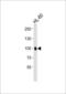 Integrin Subunit Beta 2 antibody, LS-C159941, Lifespan Biosciences, Western Blot image 