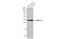 Protein Phosphatase 1 Regulatory Inhibitor Subunit 1B antibody, GTX133350, GeneTex, Western Blot image 