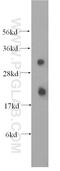 Carcinoembryonic Antigen Related Cell Adhesion Molecule 21 antibody, 17209-1-AP, Proteintech Group, Western Blot image 