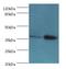 Cathepsin K antibody, LS-C375556, Lifespan Biosciences, Western Blot image 