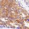 Eukaryotic Translation Initiation Factor 2A antibody, NBP2-26296, Novus Biologicals, Immunohistochemistry paraffin image 