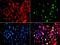 Receptor-associated protein 80 antibody, orb373580, Biorbyt, Immunocytochemistry image 