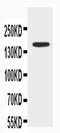 ATP Binding Cassette Subfamily B Member 4 antibody, PA2090, Boster Biological Technology, Western Blot image 