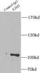 Enhancer Of Zeste 2 Polycomb Repressive Complex 2 Subunit antibody, FNab02918, FineTest, Immunoprecipitation image 
