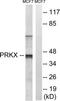 Protein Kinase X-Linked antibody, TA314392, Origene, Western Blot image 