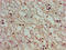 Calcium-transporting ATPase type 2C member 1 antibody, LS-C673755, Lifespan Biosciences, Immunohistochemistry paraffin image 