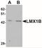 LIM Homeobox Transcription Factor 1 Beta antibody, NBP2-41194, Novus Biologicals, Western Blot image 