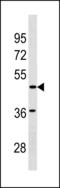 Sarcoglycan Epsilon antibody, LS-C203787, Lifespan Biosciences, Western Blot image 