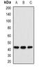 S-adenosylmethionine synthase isoform type-1 antibody, orb341137, Biorbyt, Western Blot image 