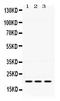 HRas Proto-Oncogene, GTPase antibody, RP1098, Boster Biological Technology, Western Blot image 