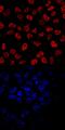 Eomesodermin antibody, PA5-47818, Invitrogen Antibodies, Immunocytochemistry image 