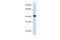 Fumarylacetoacetate Hydrolase antibody, PA5-42049, Invitrogen Antibodies, Western Blot image 