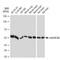 Cholinergic Receptor Muscarinic 2 antibody, GTX03184, GeneTex, Western Blot image 