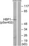 HMG-Box Transcription Factor 1 antibody, GTX55436, GeneTex, Western Blot image 