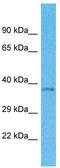Olfactory Receptor Family 4 Subfamily M Member 1 antibody, TA337512, Origene, Western Blot image 