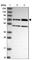 Zinc Finger Protein 467 antibody, HPA042907, Atlas Antibodies, Western Blot image 