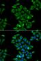 Cystinosin, Lysosomal Cystine Transporter antibody, PA5-77056, Invitrogen Antibodies, Immunofluorescence image 
