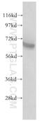 Growth Factor Receptor Bound Protein 10 antibody, 10027-2-AP, Proteintech Group, Western Blot image 