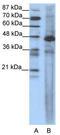 Serum Response Factor antibody, TA330105, Origene, Western Blot image 