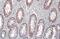 Galectin 3 antibody, GTX635155, GeneTex, Immunohistochemistry paraffin image 