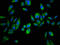 Aspartate Beta-Hydroxylase antibody, LS-B11904, Lifespan Biosciences, Immunofluorescence image 