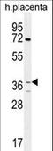 Olfactory Receptor Family 2 Subfamily AT Member 4 antibody, LS-C163162, Lifespan Biosciences, Western Blot image 