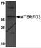 Mitochondrial Transcription Termination Factor 2 antibody, 7285, ProSci Inc, Western Blot image 