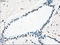 Polo Like Kinase 1 antibody, LS-C784223, Lifespan Biosciences, Immunohistochemistry frozen image 