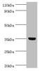 Glycine-N-Acyltransferase Like 1 antibody, orb353221, Biorbyt, Western Blot image 