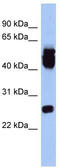 ES Cell Expressed Ras antibody, TA333412, Origene, Western Blot image 