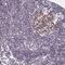 Sterile Alpha Motif Domain Containing 1 antibody, NBP2-14805, Novus Biologicals, Immunohistochemistry paraffin image 