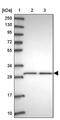 Beta-1,3-Glucuronyltransferase 3 antibody, PA5-62383, Invitrogen Antibodies, Western Blot image 