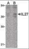 Interleukin 27 Receptor Subunit Alpha antibody, orb88288, Biorbyt, Western Blot image 