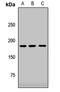 Terminal uridylyltransferase 4 antibody, LS-C668196, Lifespan Biosciences, Western Blot image 