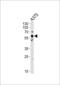 SRC Proto-Oncogene, Non-Receptor Tyrosine Kinase antibody, LS-C161488, Lifespan Biosciences, Western Blot image 