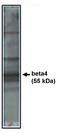 Calcium Voltage-Gated Channel Auxiliary Subunit Beta 4 antibody, MBS395764, MyBioSource, Western Blot image 